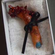 Finger Invitations and Pens